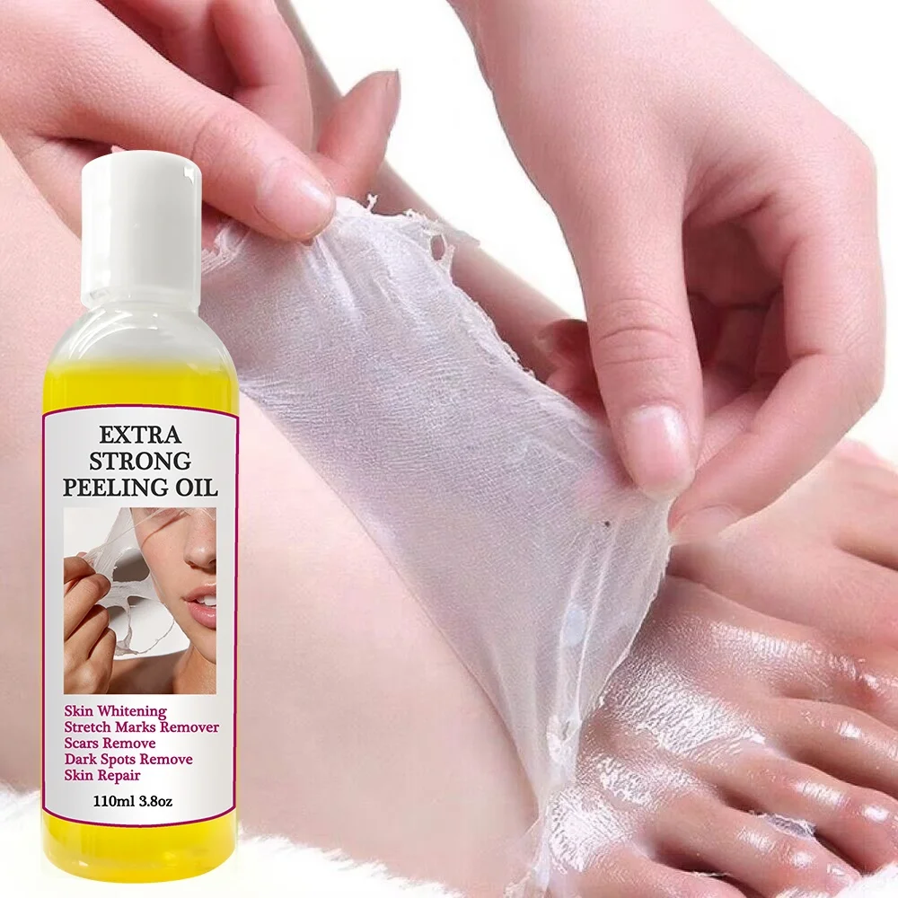 Private Label Skin Whitening Remove Dead Skin Exfoliating peeling oil For Legs Scars