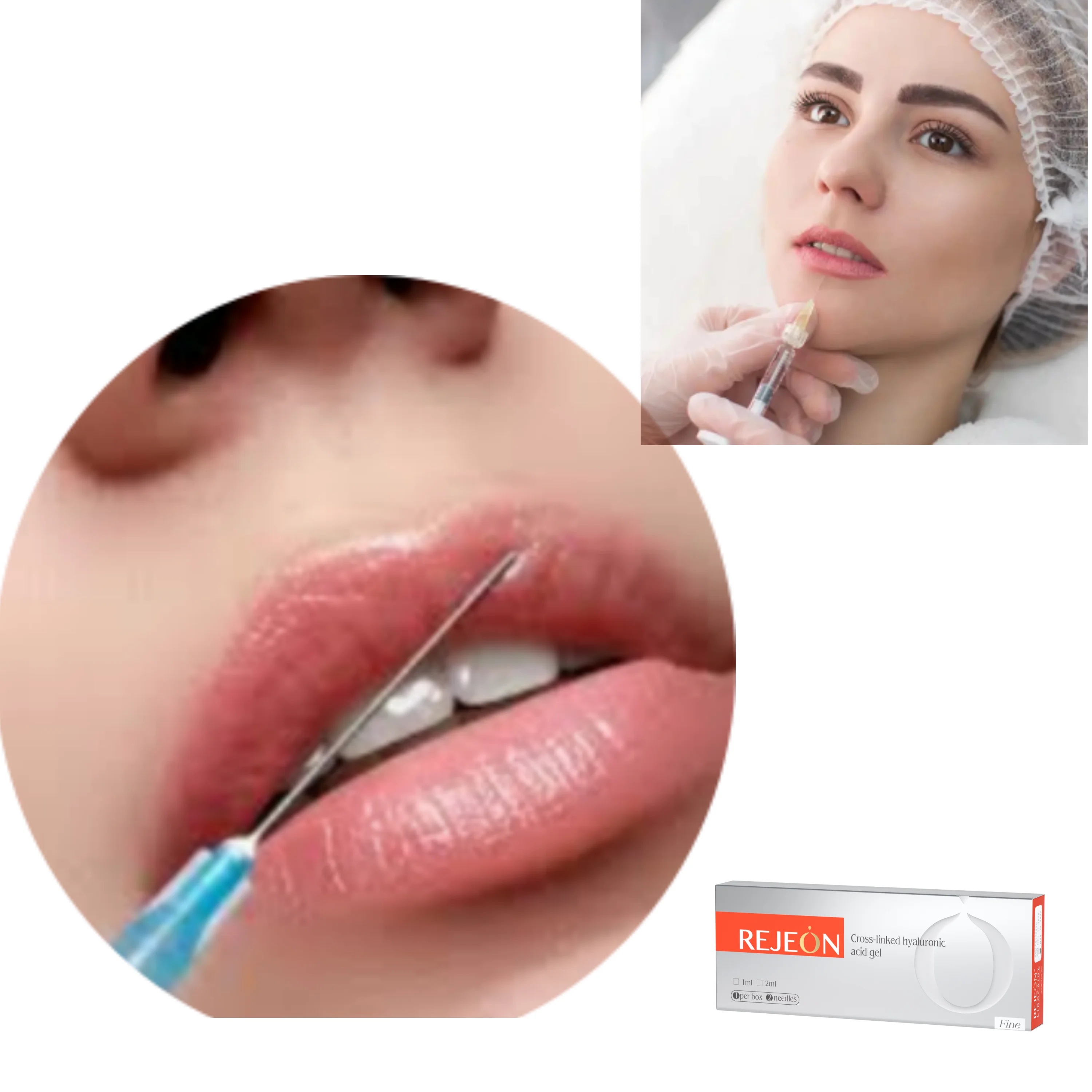 REJEON hyaluronic acid filler injection face for lip nose chin 1ml 2ml 100ml dermal filler manufacturers
