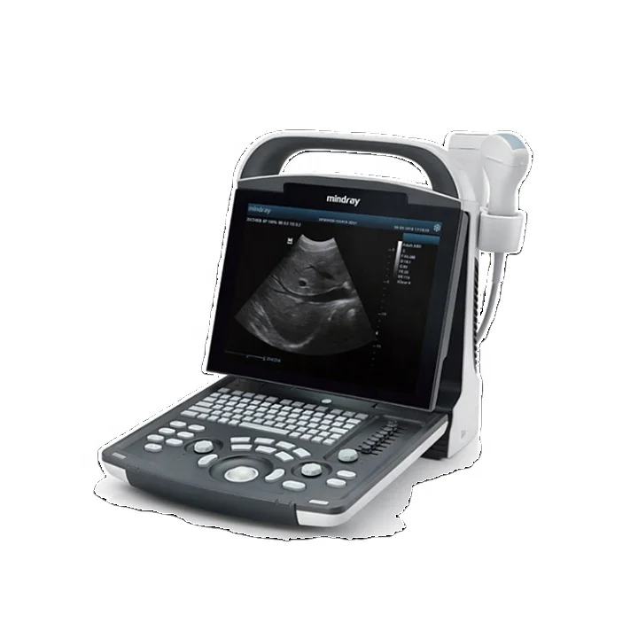 Hot sale ultrasound scanner price ultrasound scanner white black dp 10 mindray ultrasound machine china