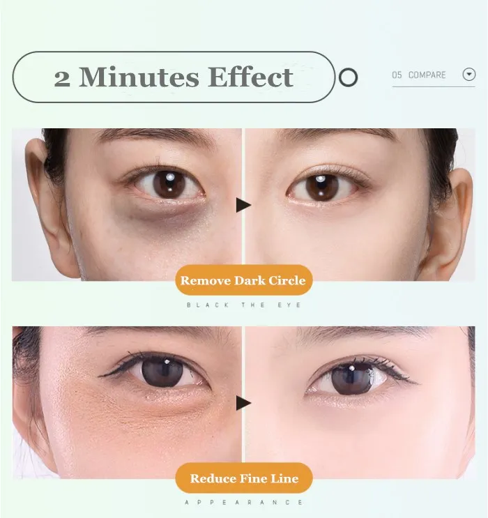 Japan Eye Bag Removal Cream for Dark Circle Treatment