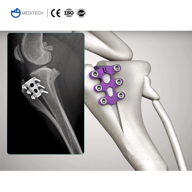 Good Quality Veterinary Orthopedic Implant for Orthopedic Veterinary Tta