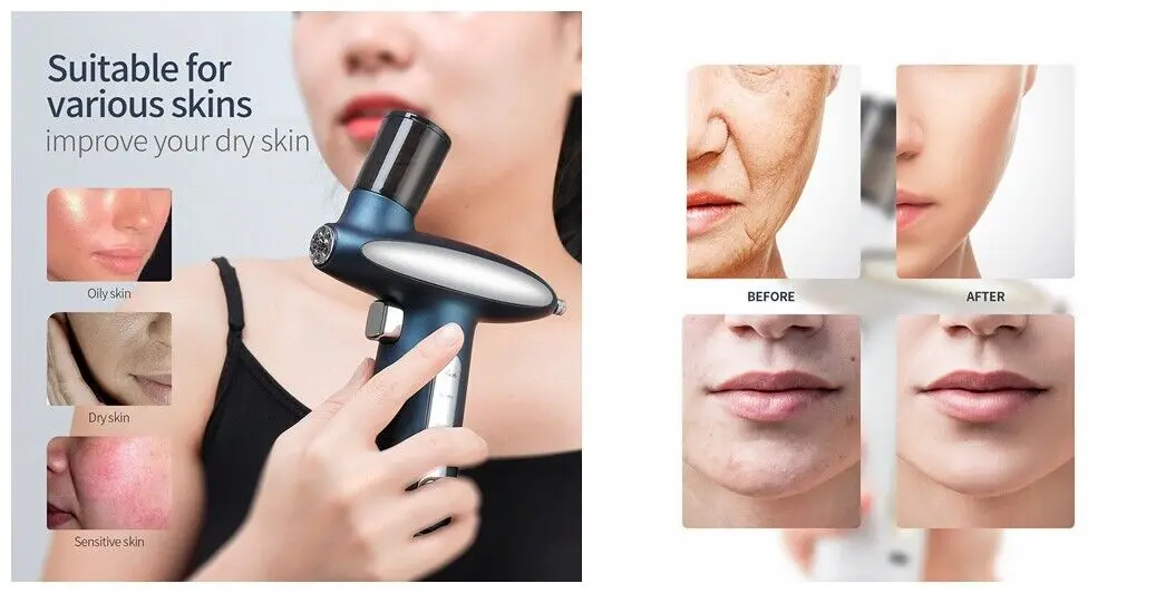 180Kpa Nano Mist Sprayer Deep Hydrating Face Humidifier Skin Moisturizing Anti Acne Injector LED Red Blue Light Oxygen Injection.jpg