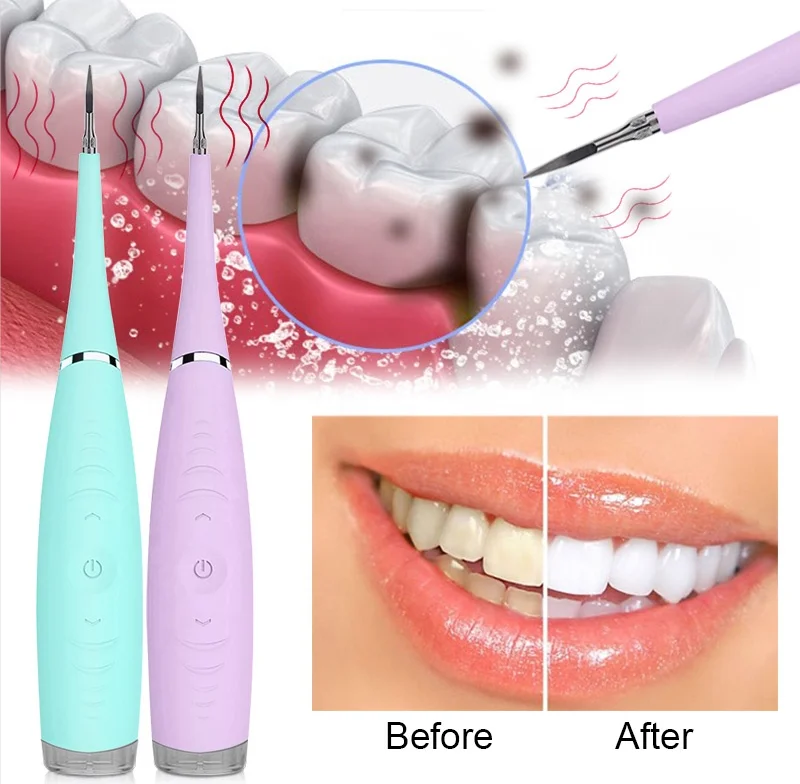 Portable Waterproof Rechargeable High Frequency Electric Dental Calculus Remover Oral Tooth Cleaner