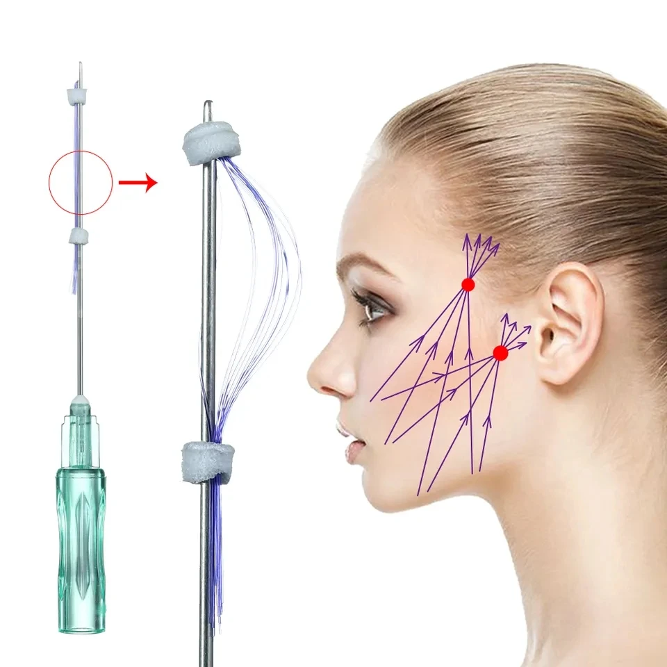 PDO hilos tensores face lift 21G38 21G 60 multi threads pcl multi threads