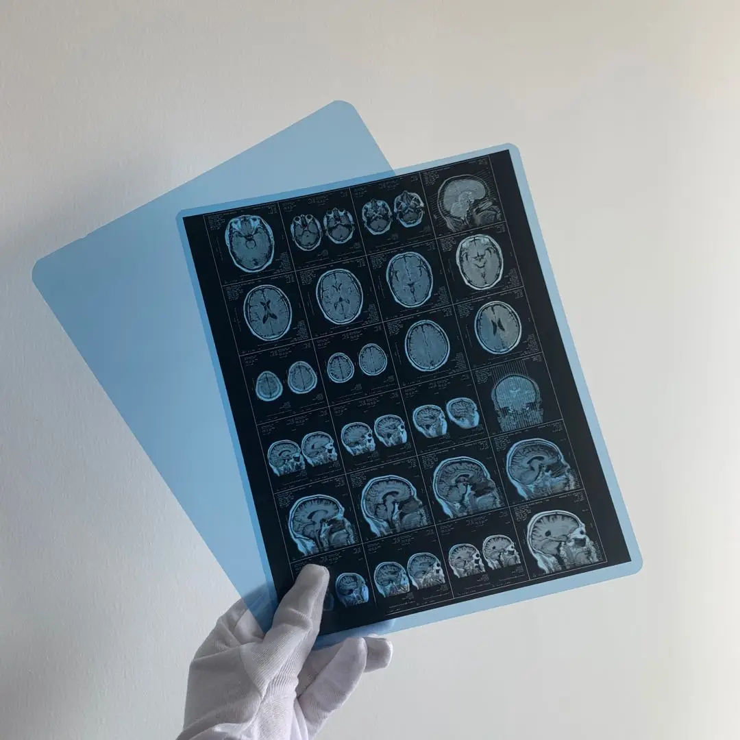 China OEM 210um Medical Blue Base X Ray Film in 8x10 14x17 Sheets