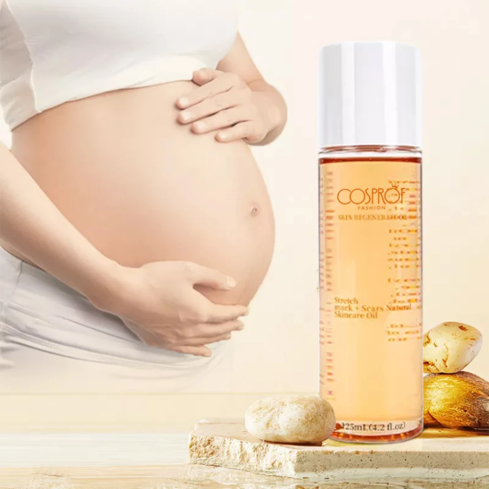 New Product Skin Regenerate Oil Stretch Mark Oil For Pregnancy Scar Removal Skin Care