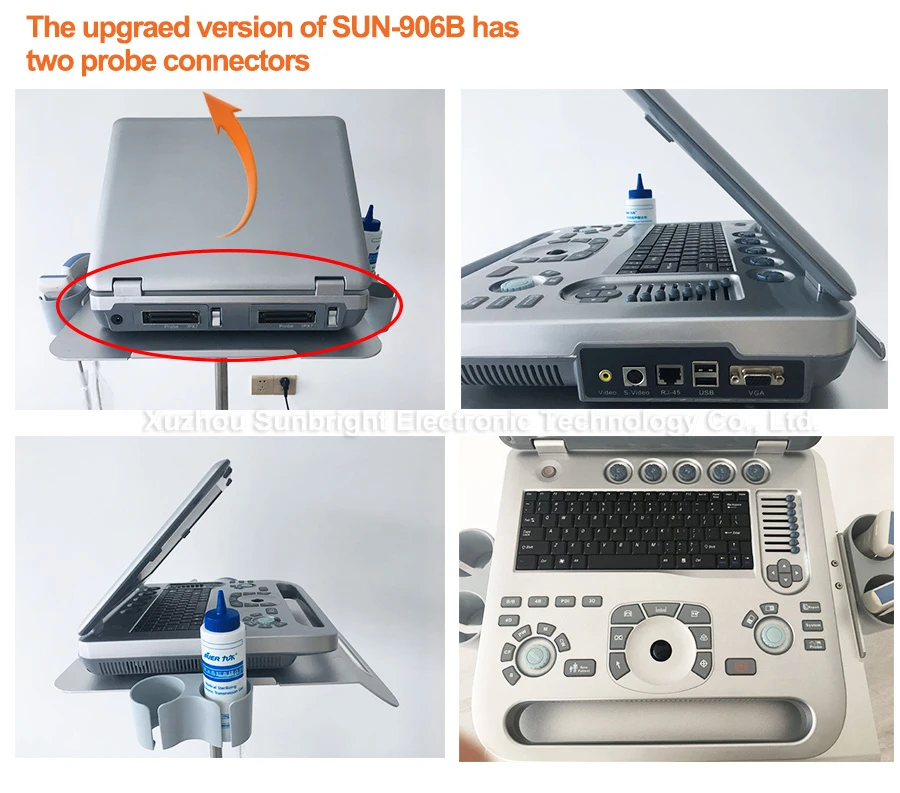 CE 4D one stop whole body diagnosis best image quality color Doppler ultrasound PW CW ultrasound baby