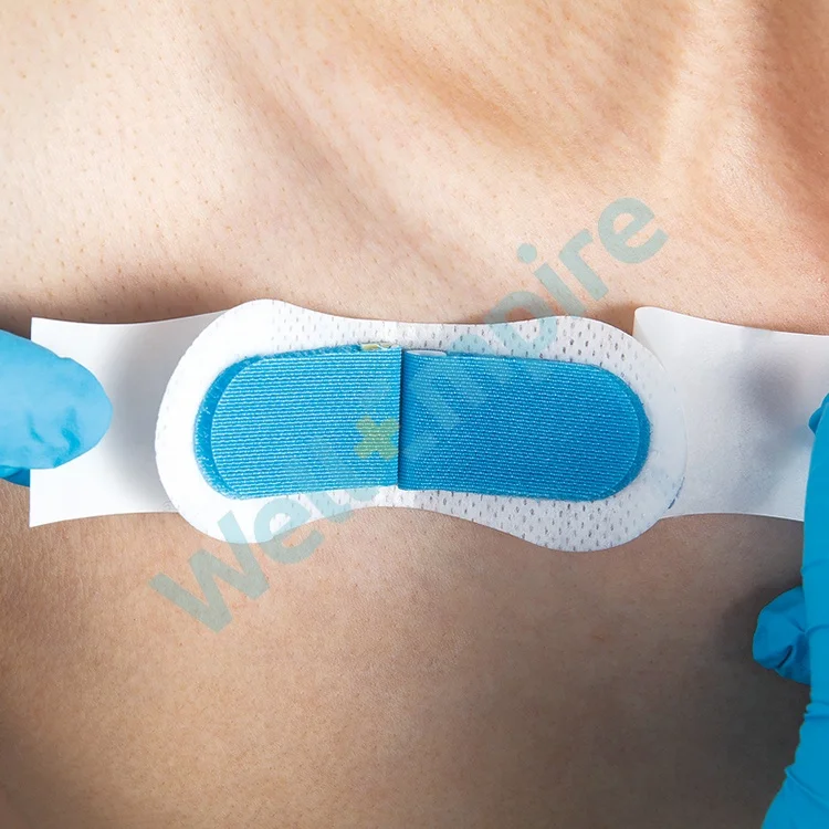 
G7 Foley Dressing Epidural Methods Umbilical Catheter Fixation 