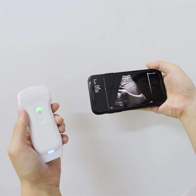 Wh-7 Site-rite Ultrasound Machine  3 In 1  Color Doppler Medical Ultrasound Instruments Wireless WIFI Ultrasonido Portatil