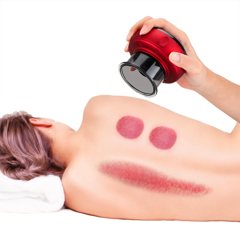 OEM Guasha Electric Cupping Scraping Suction Vacuum Massager Cupping Therapy Device