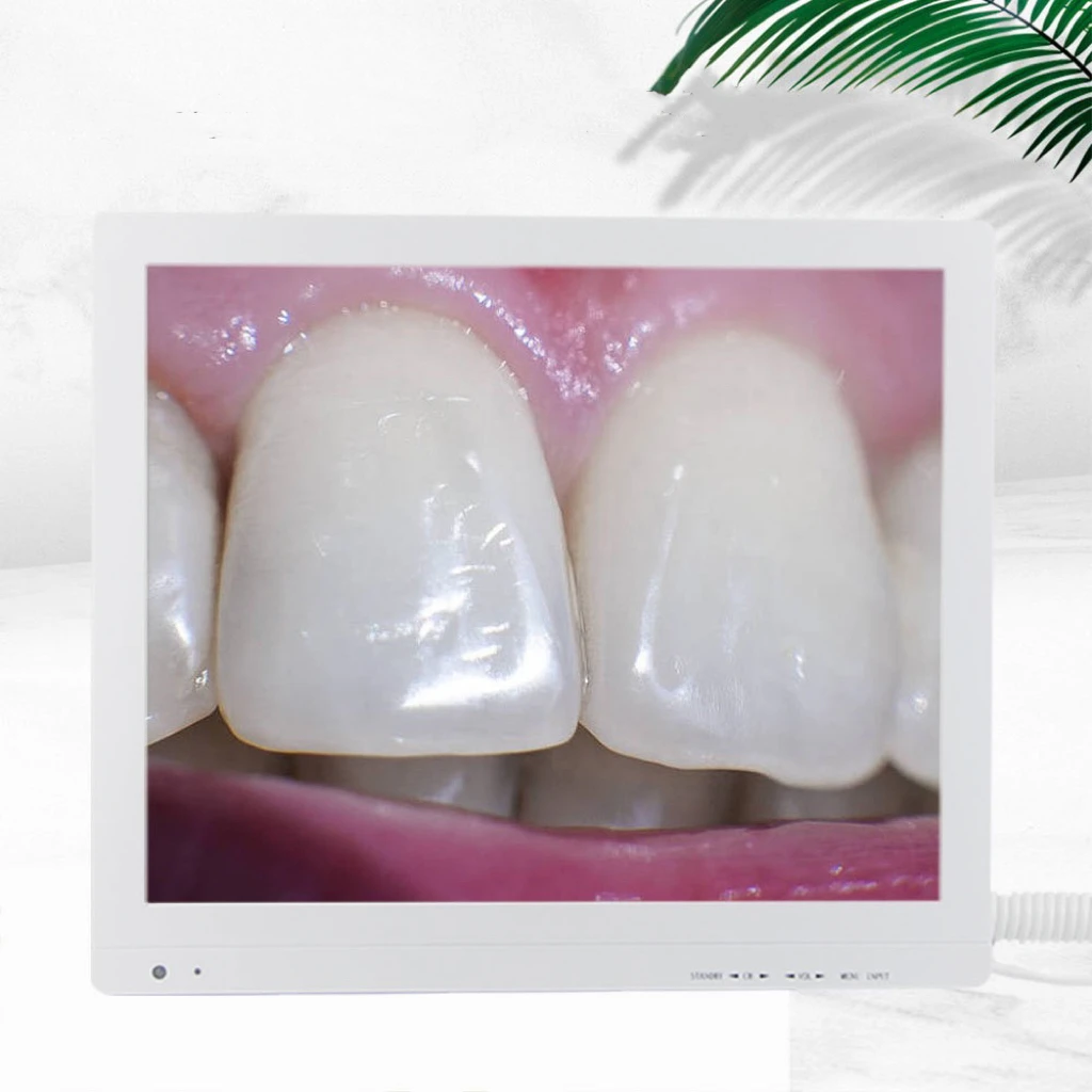 Handheld Dental Camera Oral Endoscope