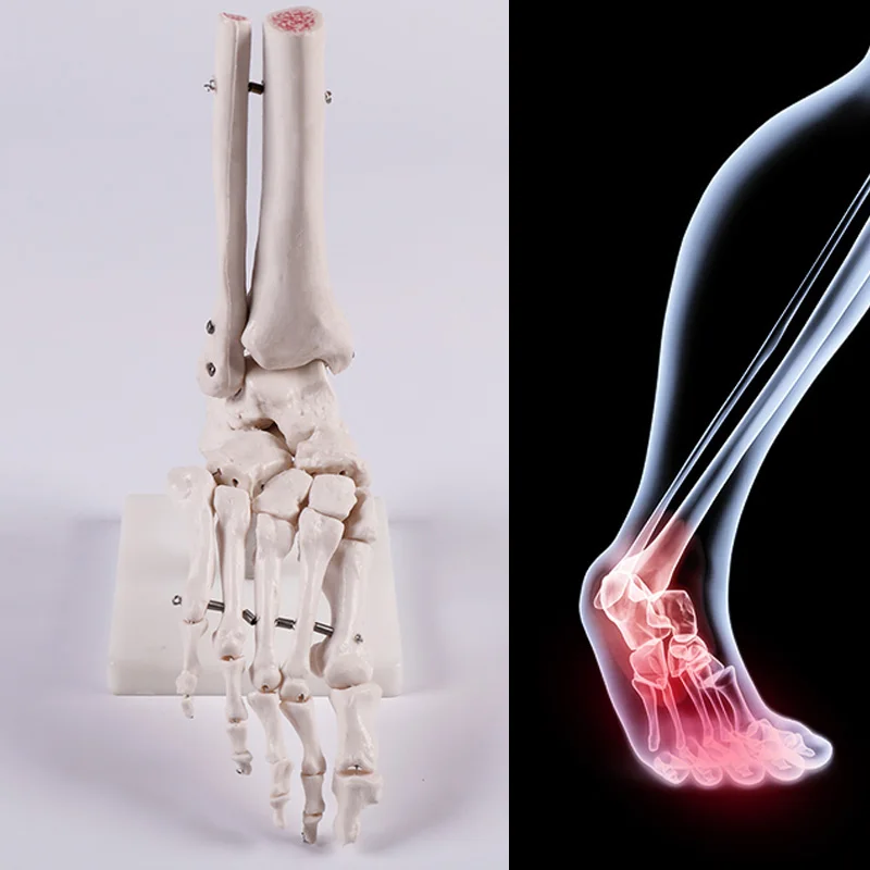 medical science Life-size Human Foot Joint skeleton Model for Disease Demonstration Medical Teaching Tool A1027