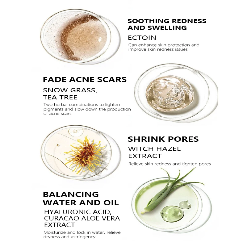 Private Label Organic Facial Soothing Repair Redness Acne Treatment Skincare Set Tea Tree Salicylic Acid Anti-acne Skin Care Set