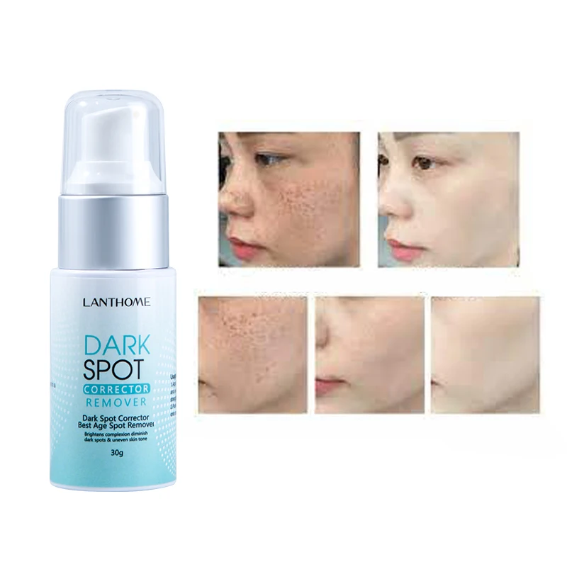 OEM 30g Natural Herbal blemish Serum Freckle Pimples Dark Spot Removal Corrector Eraser Whitening Cream