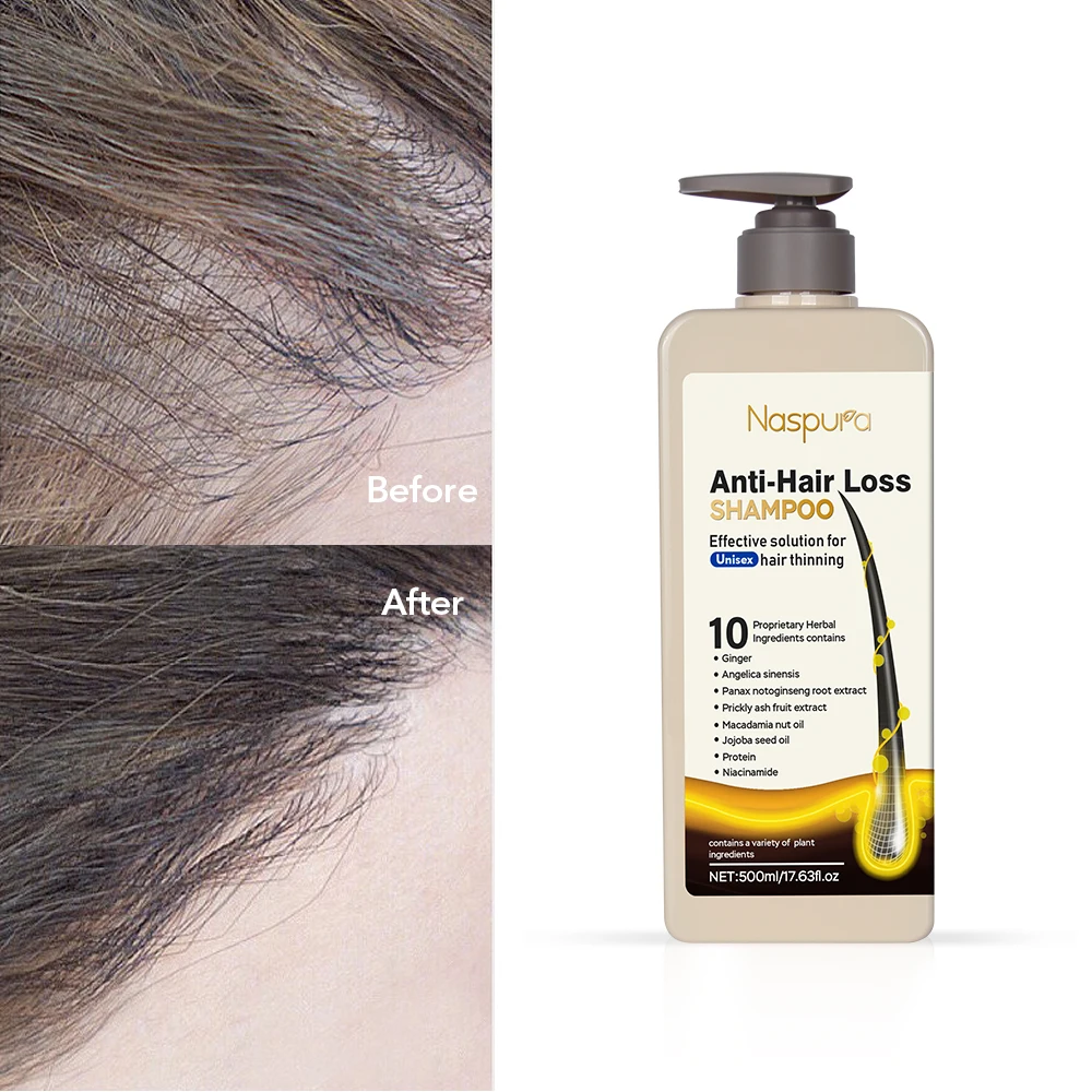 Thailand Wholesale Natural Ginger Shampoo Hair Regrowth Active Ingredients Hair Shampoo