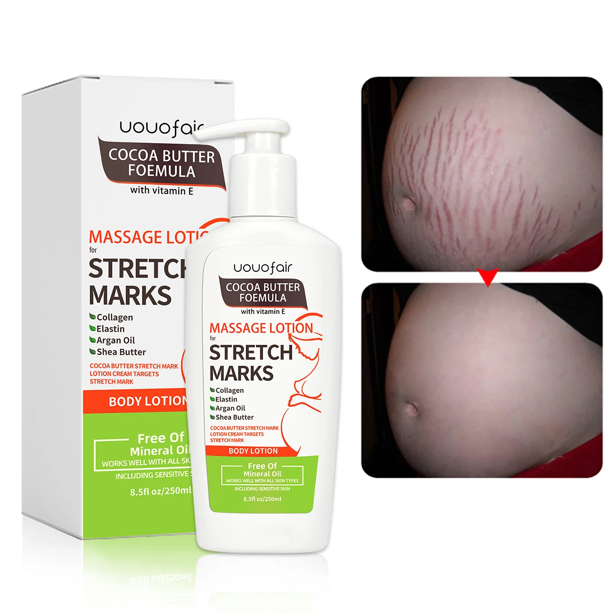 Manufacturer Free sample stretch marks removal cream