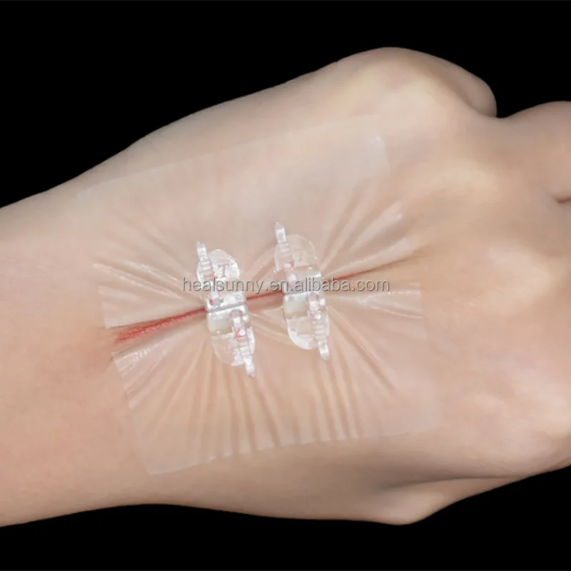 Устройство застежки на молнии без стежков