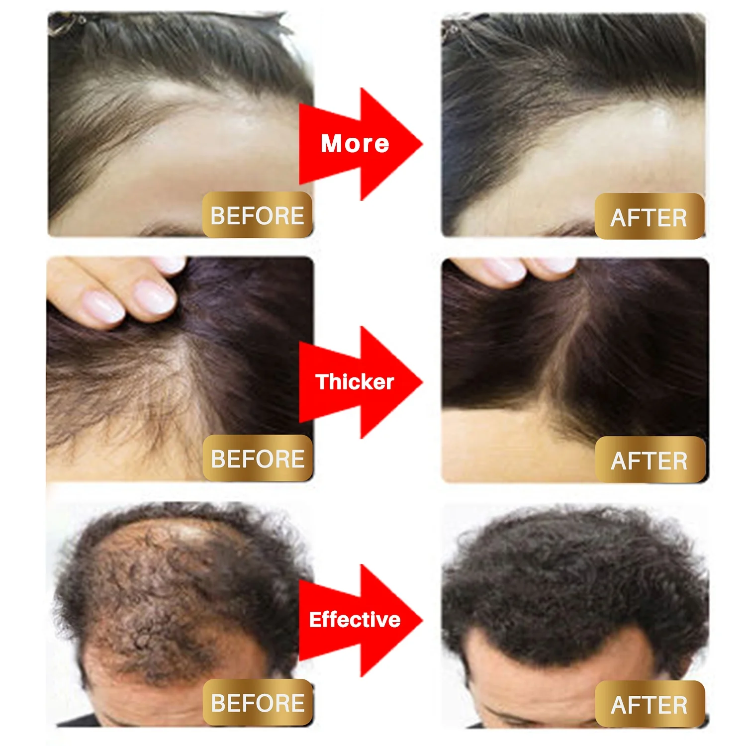 OEM Biotin Hair Growth Serum Hair Tonic Care Serum Grow Healthy Strong Hair Suitable for Men and Women
