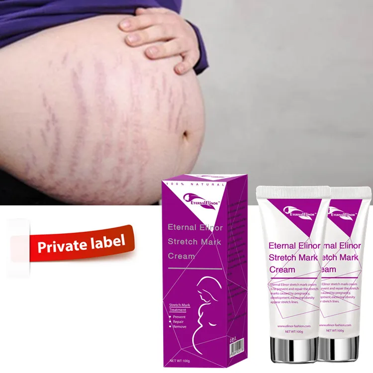 Крем Для Удаления растяжек, гель для взрослых, женский крем для отбеливания, индивидуальная этикетка, уход за кожей, OEM 3 года, 100 г, 10 шт.