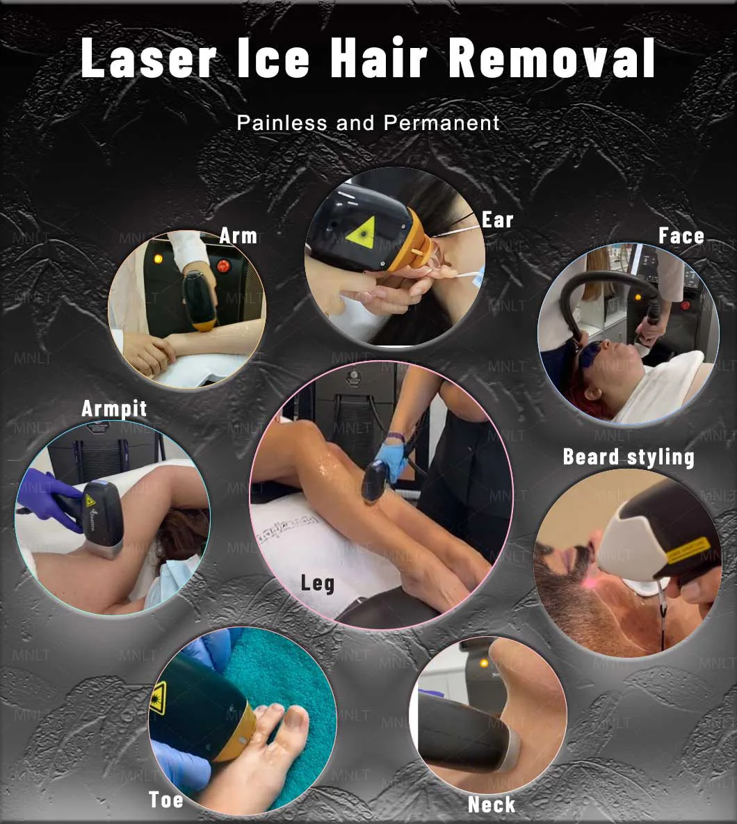 Medical CE approved Hottest Machine Device 808 Diode Laser Hair Removal for spa