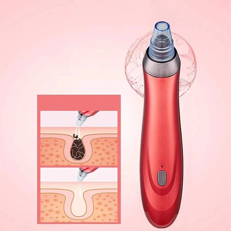 5 в 1 уход за кожей лица noblackhead se акне черный горошек для маленьких девочек прыщей очиститель пор Remover инструмент мужчин