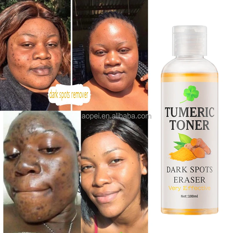 Free Sample Tumeric Dark Spots Toner Spots Eraser Corrector Turmeric Fades Blemishes Dark Spots Remover Acne Remover Toner