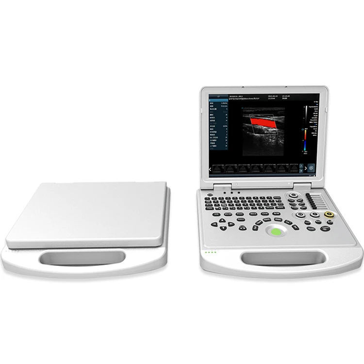 4D 5D Medical ultrasound instruments laptop for clinic hospital portable color doppler ultrasonic ecografo portatil