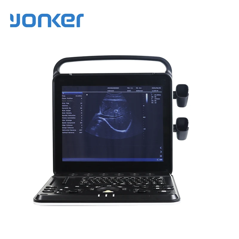 Yonker Portable Breast and neck examination portatil ultrasonic doppler color ultrasound scanner machine