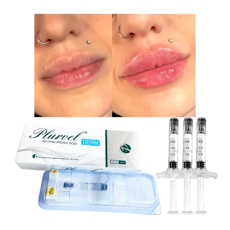 PLURVEL Factory Store Derm 1ml Cross Linked Best Acid Hyaluronic Beauty Filler Injection for Lip Augmentation Dermal Lip  Filler