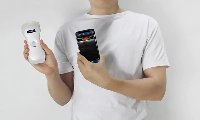 Беспроводной пальмовый двойной ультразвуковой зонд 192E