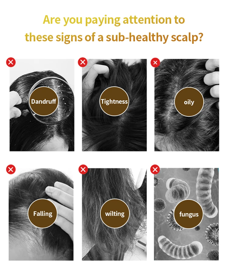 Scalp Physiotherapy Instrument Meridian Massage Micro-Current Scalp Dredge To Prevent Hair Loss Salon Device Amy Beauty