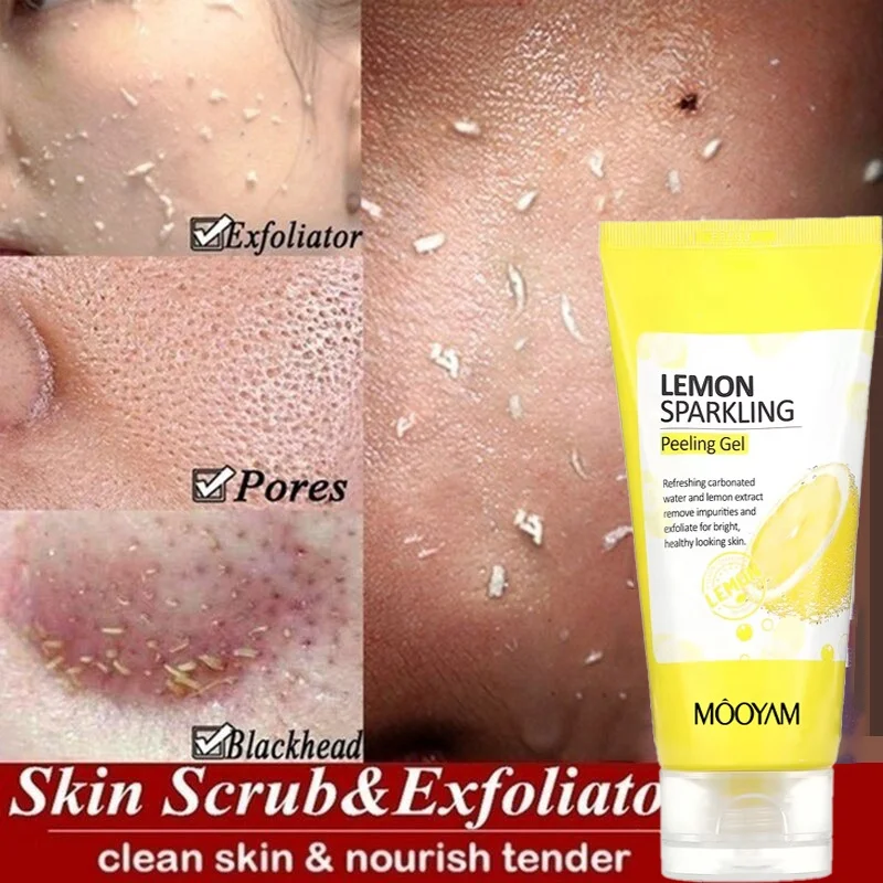 Lemon Sparkling Peeling Gel Facial Scrub Cleanser Gel Skin Care Whitening Acne Blackhead Exfoliating Gel