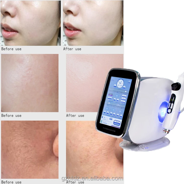 Hot Sale EMS RF Microneedling Micro Needle Morpheus 8 Fractional Rf Machine With 10 Pins 25 Pins 64 Pins Treatment Heads