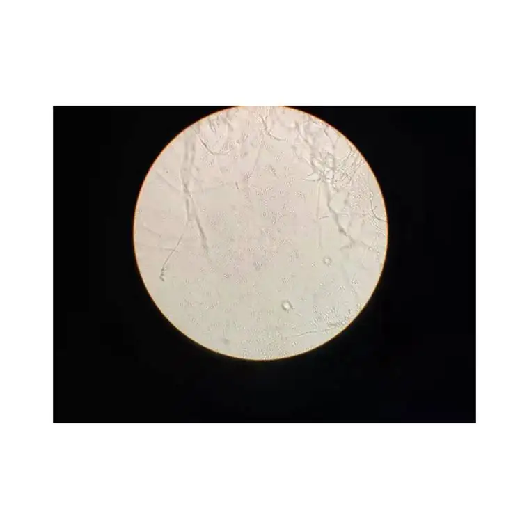 
Wholesale Locust And Beauveria Bassiana Commercial Pesticides Manufacturers 