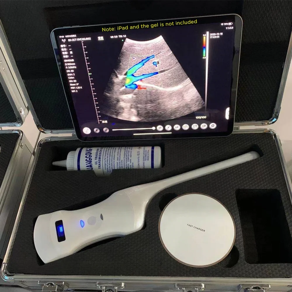 Clarius Transvaginal 192 Elements Wireless Color Doppler Ultrasound Double Head 6.5/8 MHz HD Image Quality