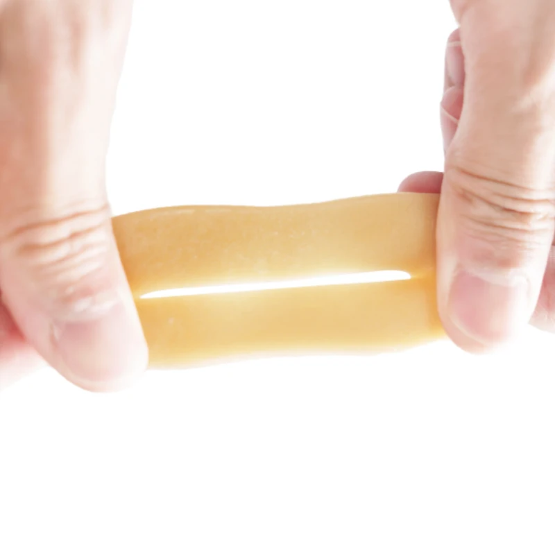 Colostomy mouldable ring with CE approved for stoma surgery patients ostomy accessory