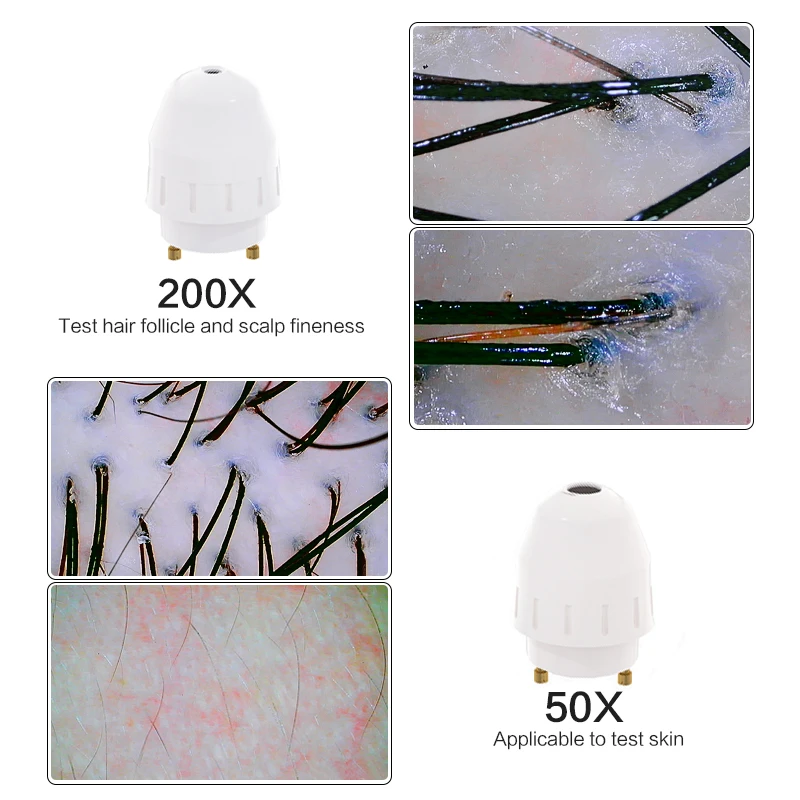 Hair salon dedicated HD hair skin detector all-in-one scalp scanner