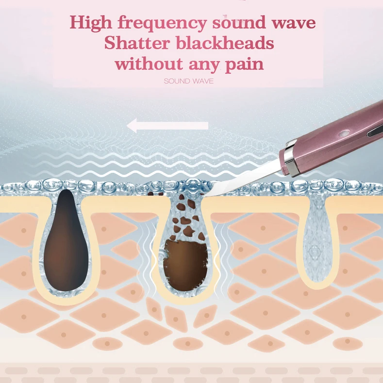 Ion Facial Cleansing Skin Scrubber Sonic Waterproof Sonic Facial Skin Scrubber Ultrasonic Skin Scrubber Portable