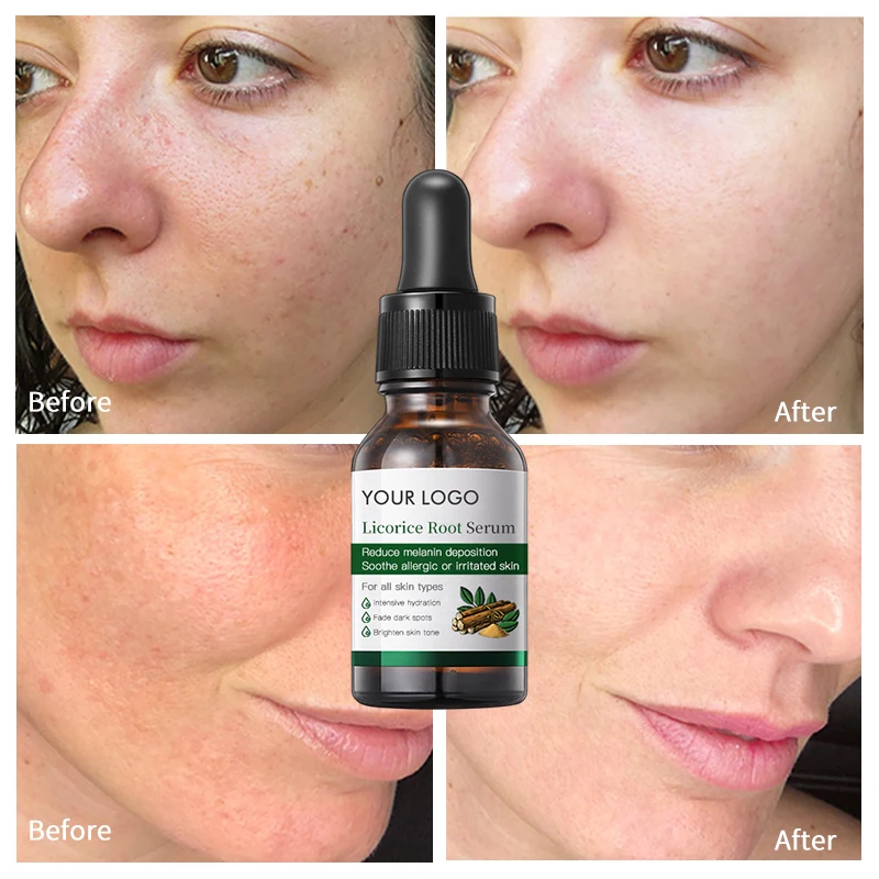 Whitening Smoothing Dark Spot Corrector Licorice Root Face Serum Lightening Acne Marks Oil With Arbutin Vitamin C