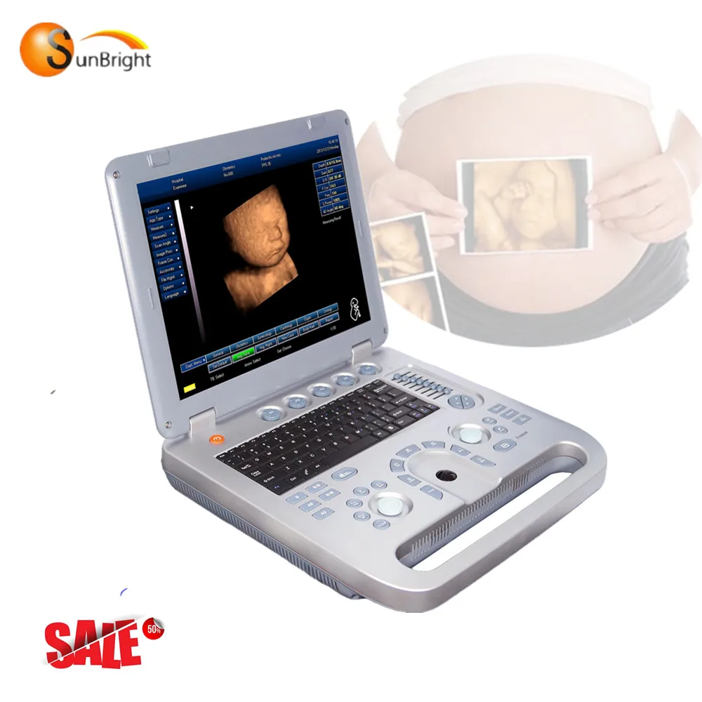 Ноутбук биопсии простаты ультразвуковой сканер SUN-800D