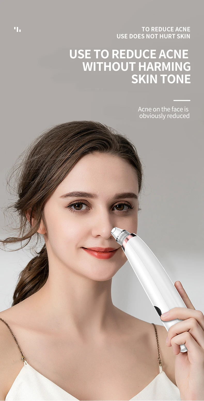 vacuum blackhead remover