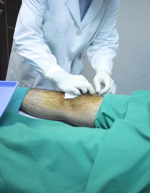 
new products 2019 innovative product hyaluronic acid gel knee joint injection for Wrinkle Correction 