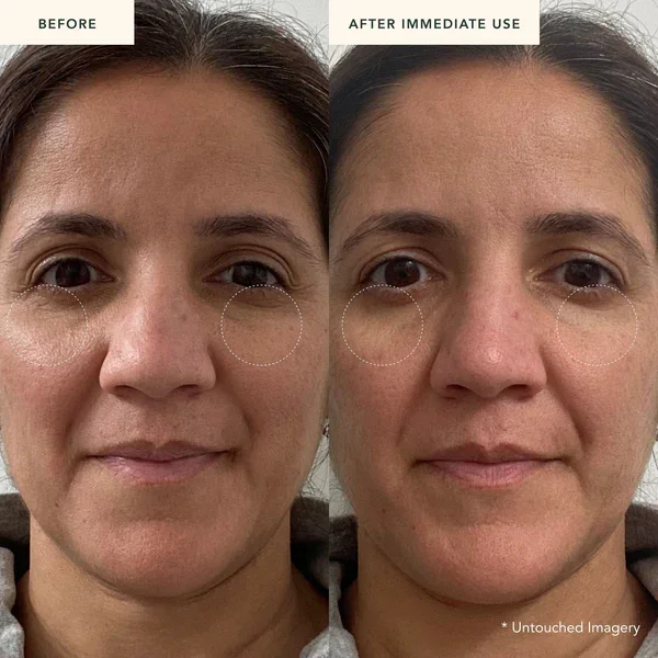 Lance Private Label Pure Retinol Face Serum Firming Reduces Fine Lines Anti Wrinkle Retinol Reverse Facial Serum