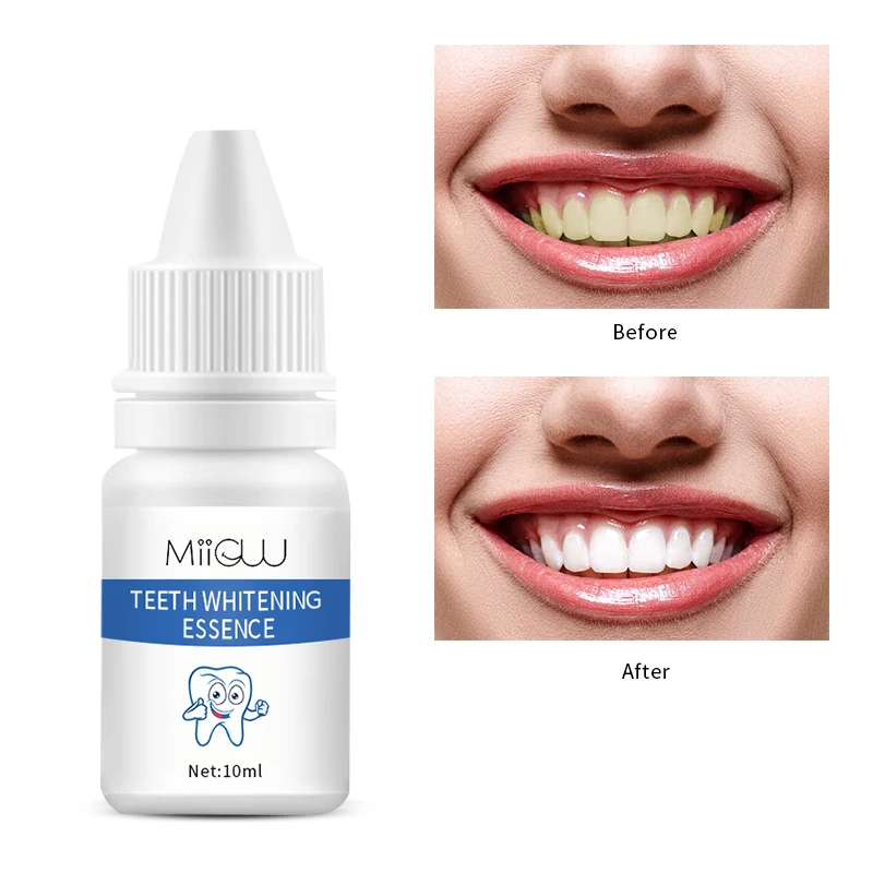 New Product Oral Hygiene Spotless Stains Remover Shining Confident Smile Teeth Whitening Essence