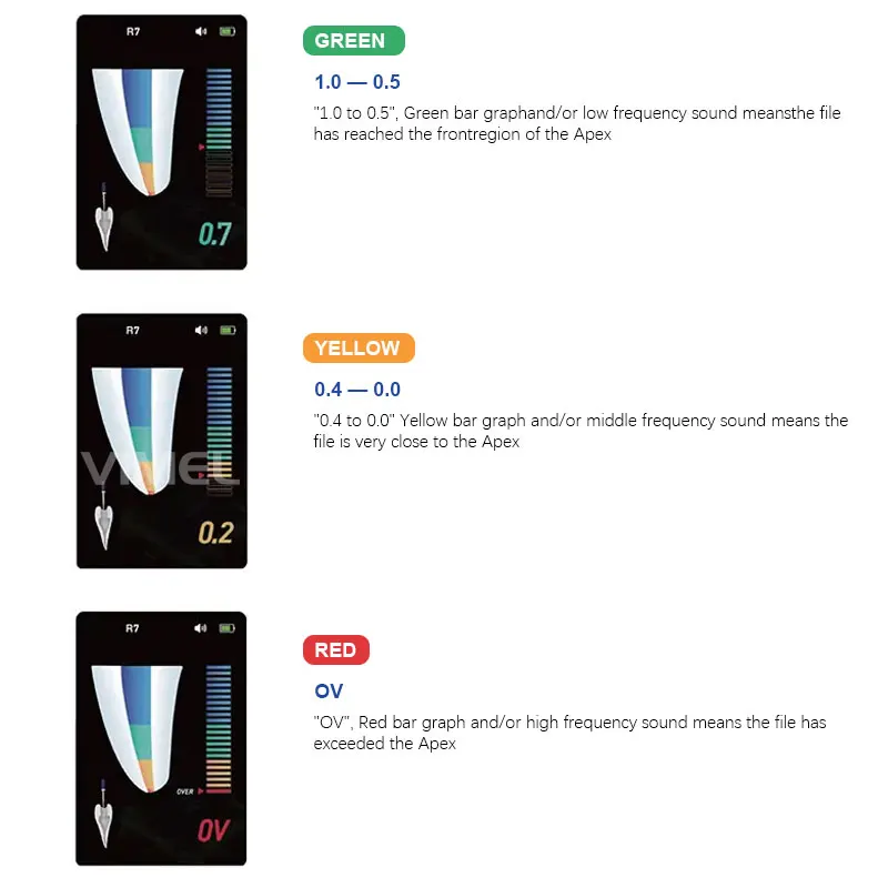 New R7 Dental Apex Locator  with LCD Screen Mini Size 3.5 TFT Intelligence Accuracy Endodontic Measure Instrument