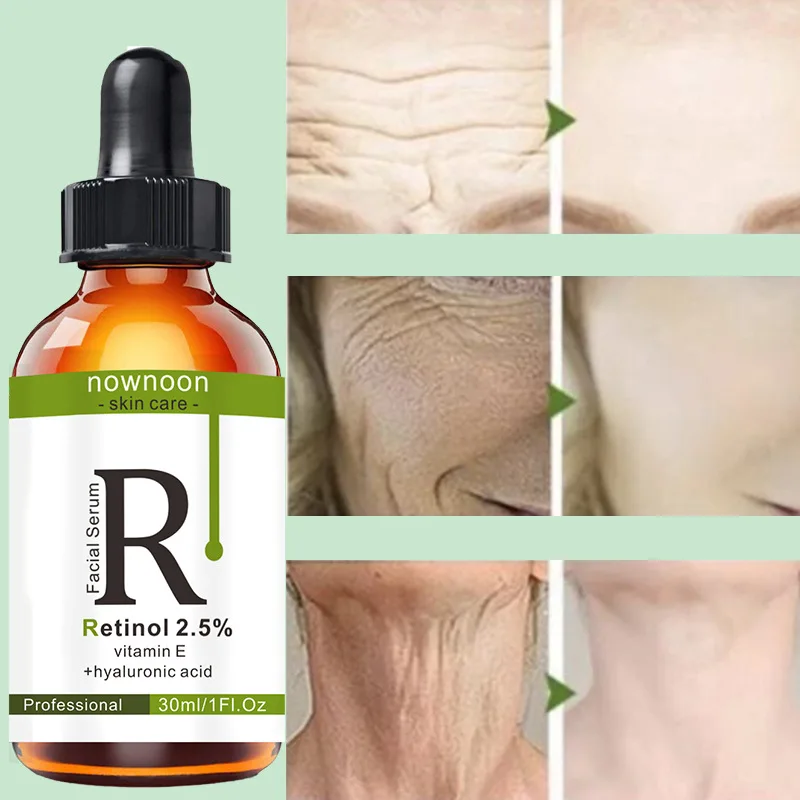 Retinol Face Serum 30ml Whitening Essence, Moisturizing, Hydrating, Lifting. Remove Blackheads  WrinklesRetinol Face Serum