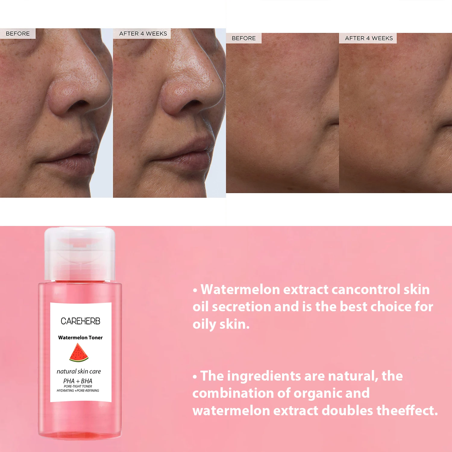 OEM Skin Care Pore Minimizer Exfoliating Hydrating Brightening PHA BHA Watermelon Glow Facial Toner