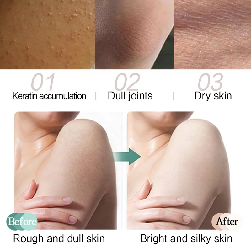 Organic Sugar Scrub Private Label Wholesale Exfoliating Whitening Face Body Scrubs