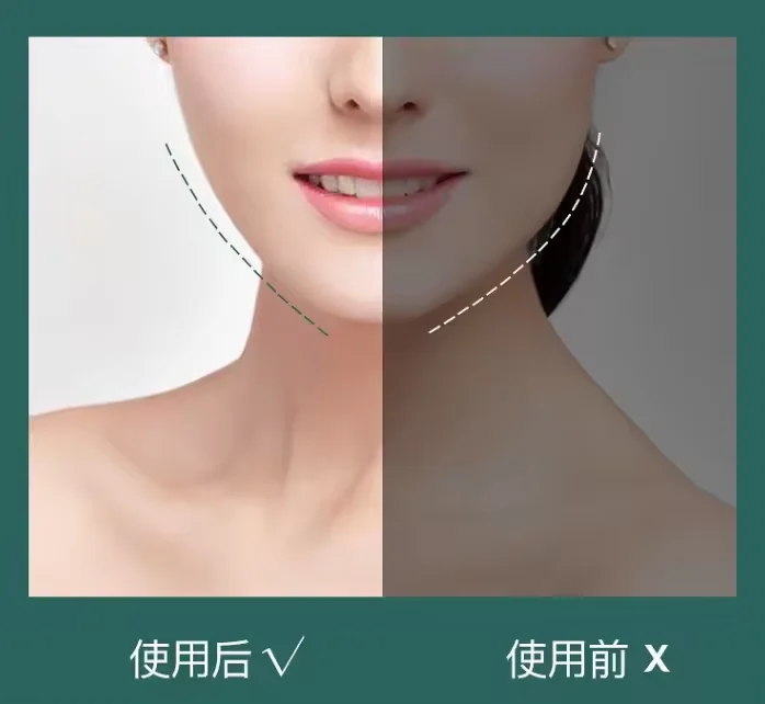 2024 New Environmentally Friendly Reusable Green Pink Double Chin Tightener V Line Mask Facial Slimming Strap V Face Lift Belt