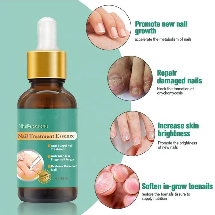 OEM Anti Fungal Treatment Finger Gel Beauty Care Nail